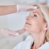 Facelift & Neck Lift