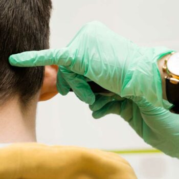 Отопластика