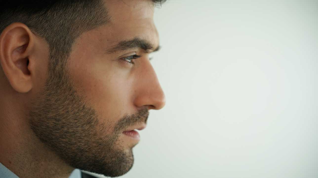 Rhinoplasty Revision