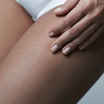 Thigh Liposuction
