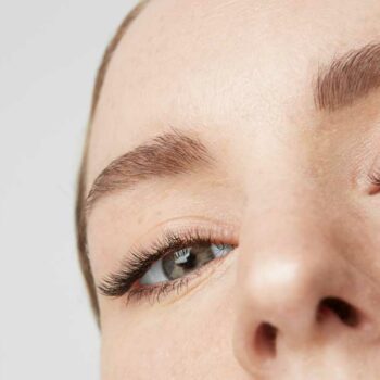 Upper Eyelid Removal