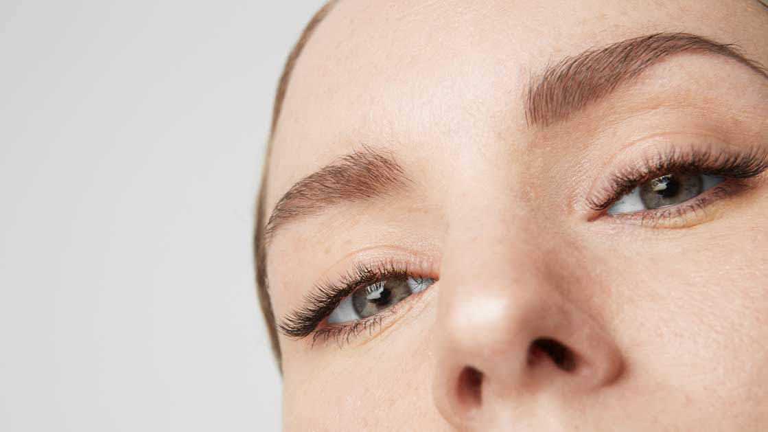 Upper Eyelid Removal