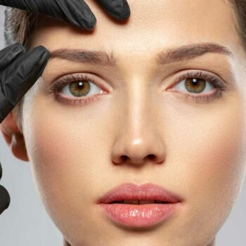 endoscopic brow lift