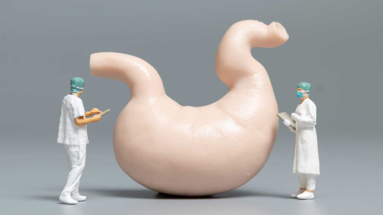 Gastric Sleeve Surgery: A Path to Sustainable Weight Loss