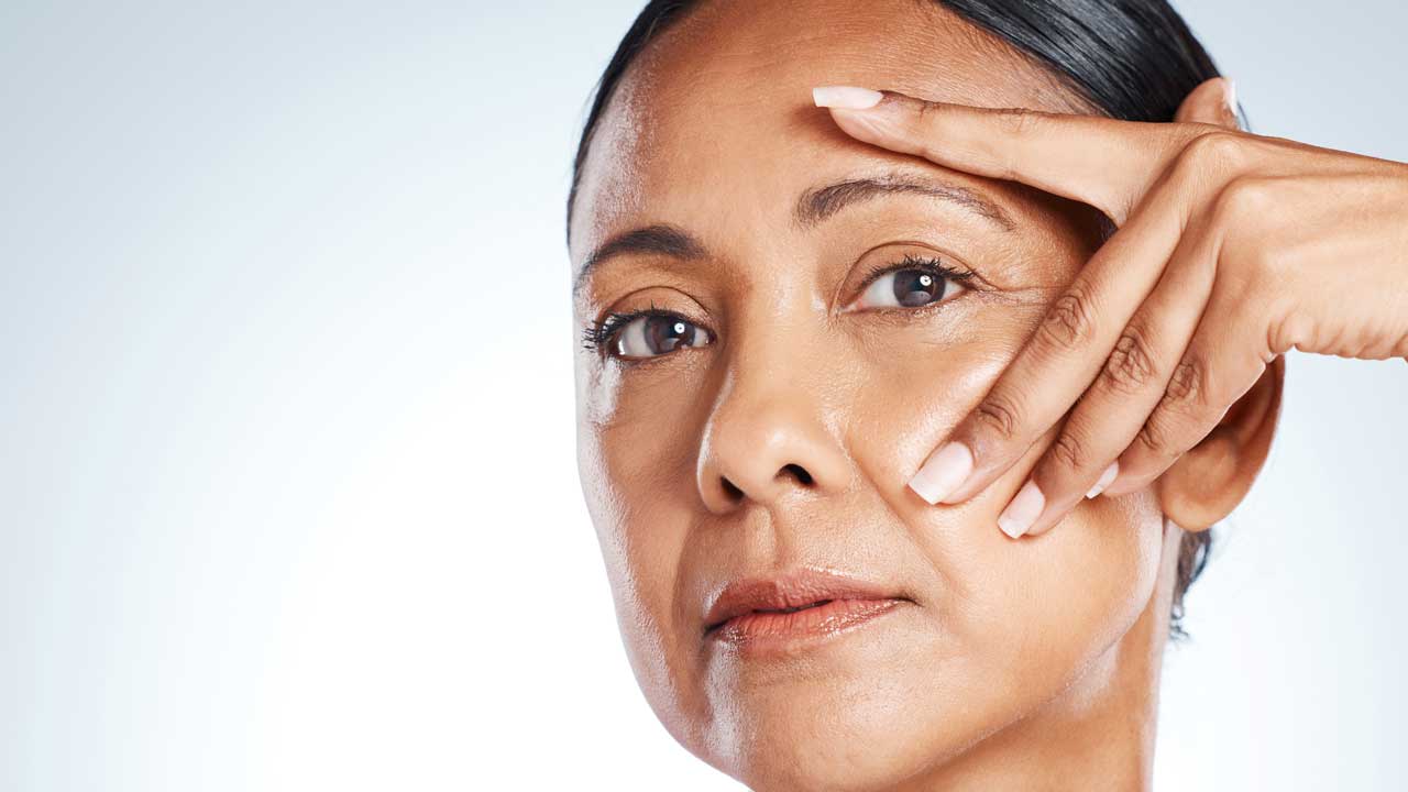 Upper Eyelid Surgery