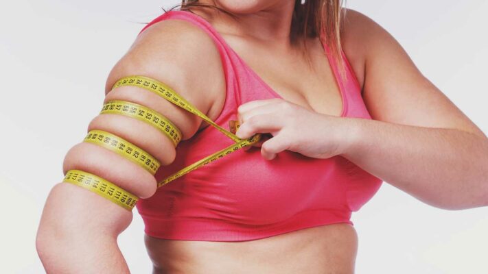 Arm Liposuction: What to Expect