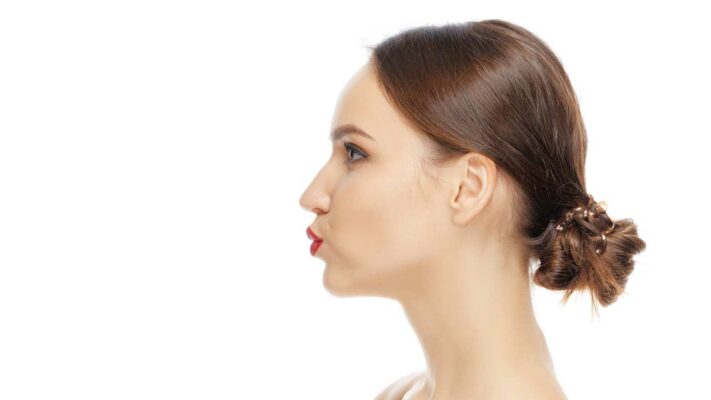Achieving Facial Balance with Chin Reduction